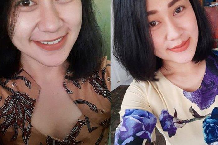 Eva Sofiana Wijayanti, perawat di Malang yang dibakar oleh <a href='https://manado.tribunnews.com/tag/pria-misterius' title='pria misterius'>pria misterius</a>. 