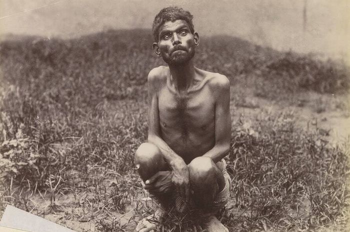 Potret Dina Sanichar, yang dikenal luas sebagai Mowgli di kehidupan nyata, diambil gambarnya antara tahun 1889 dan 1894. (Wikimedia Commons)