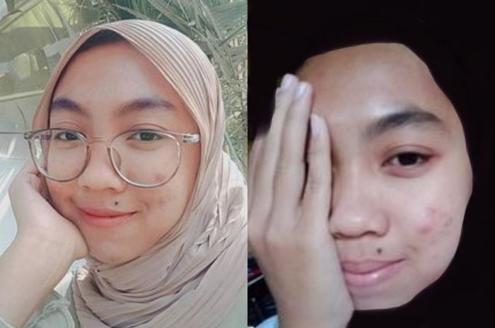 Jurnal Pejuang Jerawat Sinta Cahyaningsih Sulit Menemukan Facial Wash Yang Cocok Hingga Coba Coba Pakai Pasta Gigi Untuk Hilangkan Jerawat Semua Halaman Stylo