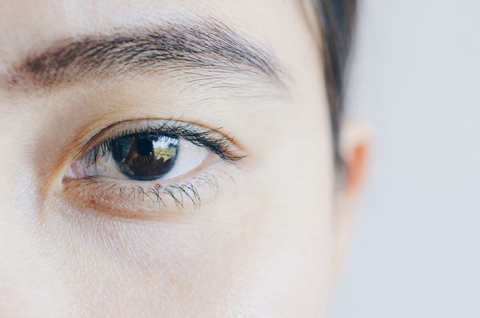 Menangis Semalaman, Ini 8 Cara Menghilangkan Mata Bengkak dengan Cepat