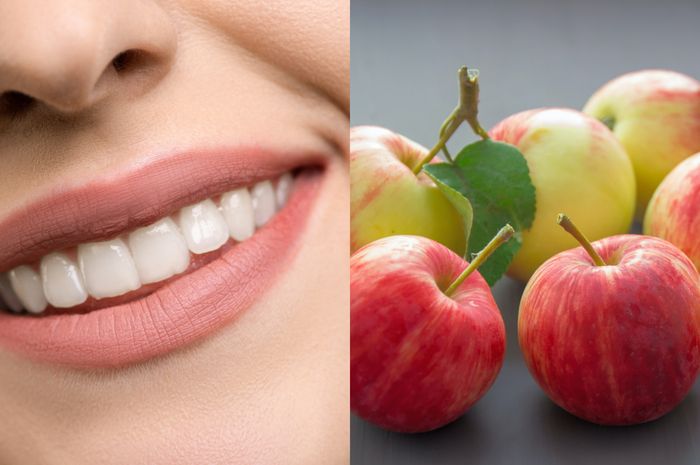 Manfaat buah apel untuk merontokan karang gigi.