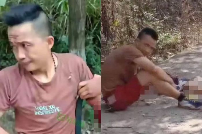 Pria yang viral yang tetap tenang meski tangannya terputus setelah mengalami kecelakaan.
