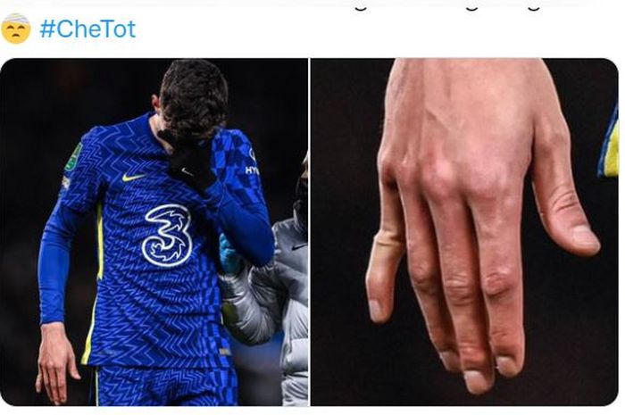 Kai Havertz mengalami patah jari setelah cetak gol Chelsea ke gawang Tottenham Hotspur di leg 1 semifinal Piala Liga Inggris (5/1/2022).