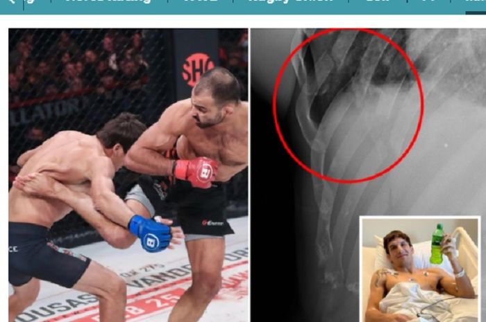 Tendangan Andrey Koreshkov di Bellator 274 bikin Chance Rencountre alami lima patah tulang rusuk dan paru-paru tertusuk.