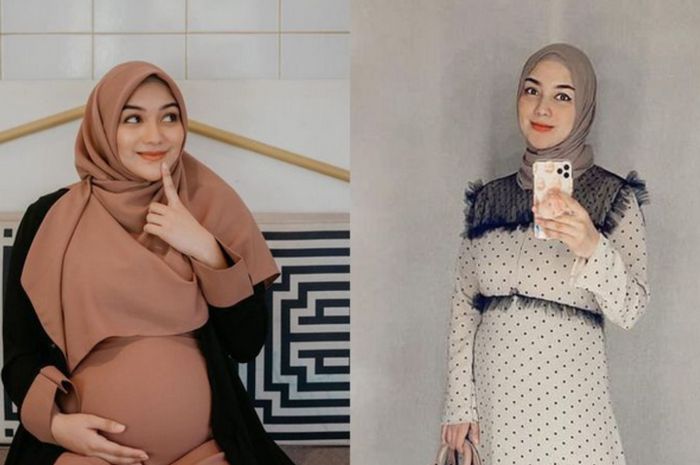 Citra Kirana sebelum dan setelah melakukan diet.