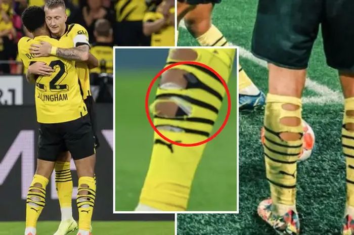 Kaus kaki pemain Borussia Dortmud Jude Bellingham yang terlihat penuh sayatan yang menciptakan sobekan besar.