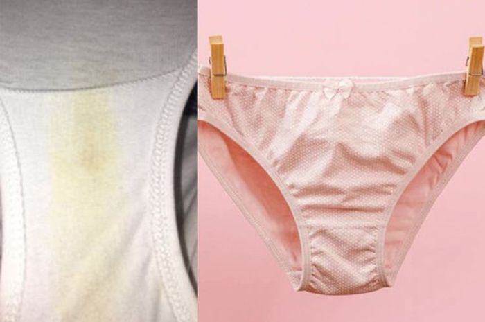 Boros Kalau Beli Baru Terus, Noda Kuning di Celana Dalam Bisa Langsung
