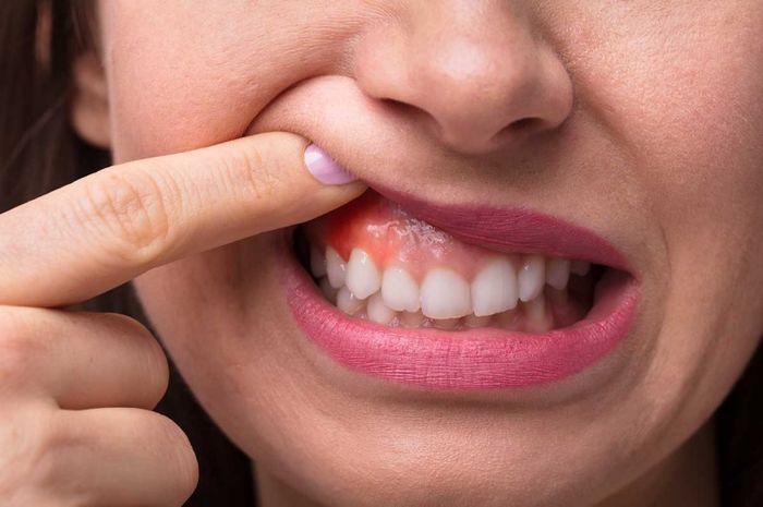 6 signos tempranos de cáncer oral deben estar alerta y no ignorarse