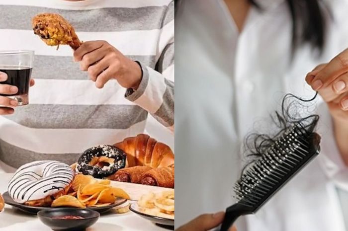Ternyata Rambut Rontok Parah Bisa Gegara 5 Kebiasaan Makan yang Buruk ...
