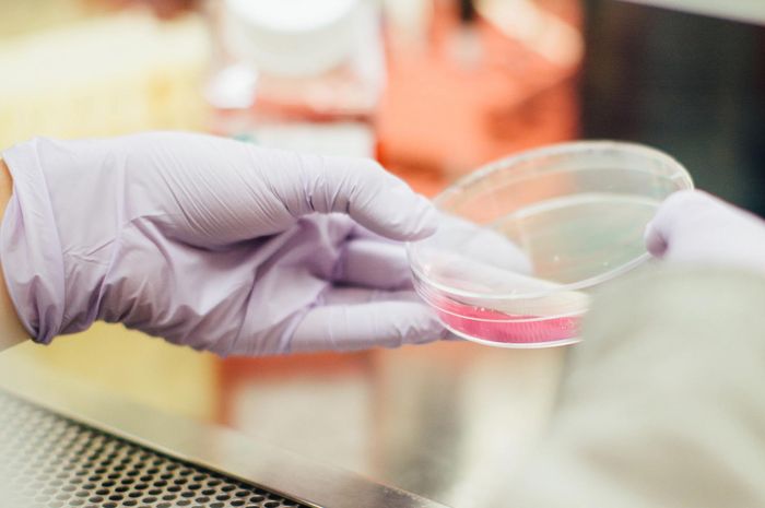 Jenis-Jenis Bakteri Berdasarkan Bentuknya - Adjar