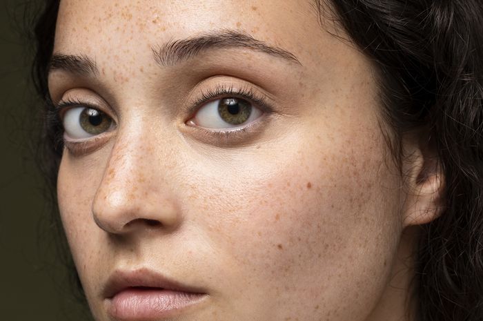 Jenis Kulit Kombinasi dan Berjerawat, Begini Cara Mengatasinya! - Stylo