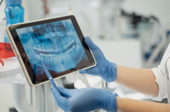 Cek di Sini! Biaya Rontgen Gigi di Rumah Sakit Tanpa BPJS Kesehatan