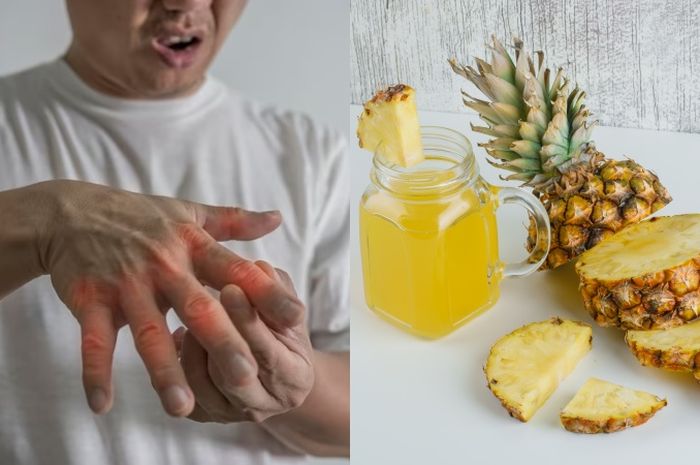 nanas untuk meredakan asam urat