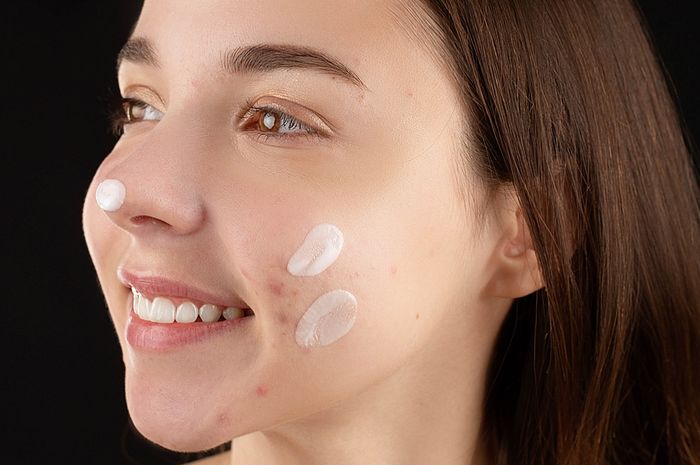 4 Rekomendasi Obat Penghilang Bekas Jerawat yang Menghitam, Ampuh! - Stylo