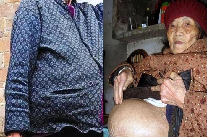 HAMIL di Umur 91 Tahun, Kondisi Nenek Ini Bikin Para Dokter Syok, Rahasia Besar yang Disembunyikan 60 Tahun Terbongkar