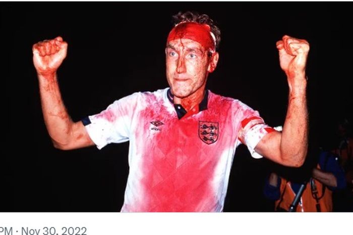 Bek Timnas Inggris, Terry Butcher, bersimbah darah setelah melakoni laga melawan Swedia di Kualifikasi Piala Dunia 1990, 6 September 1989.