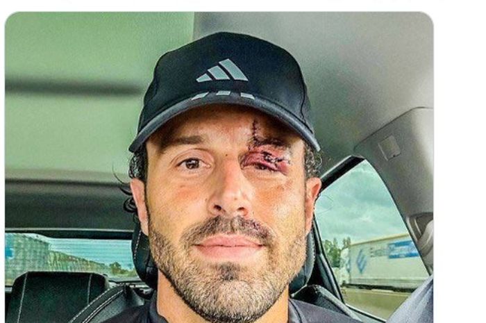 Liga Prancis - Pelatih Lyon Luka Serius akibat Ulah Suporter Marseille sebelum Pertandingan untitledajpg 20231101065823