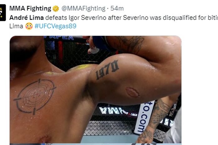 Bekas gigitan Igor Severino yang didiskualifikasi dalam laga melawan Andre Lima di UFC Vegas 89, Minggu (24/3/2024) WIB.