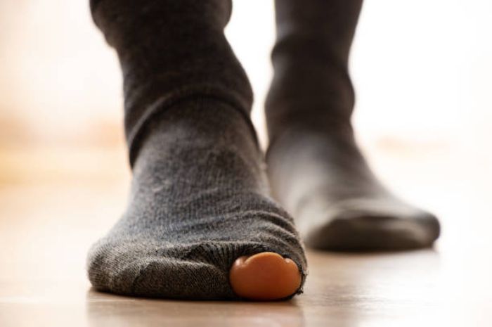 4 Arti Mimpi Kaus Kaki Bolong Jangan Disepelekan, Pertanda Hilang Kepercayaan sampai Ada Masalah Hidup