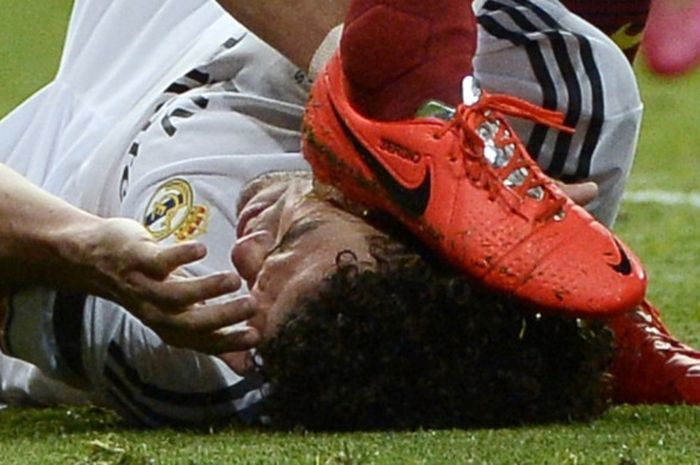 Pepe saat diinjak oleh Sergio Busquets di laga El Clasico tahun 2014