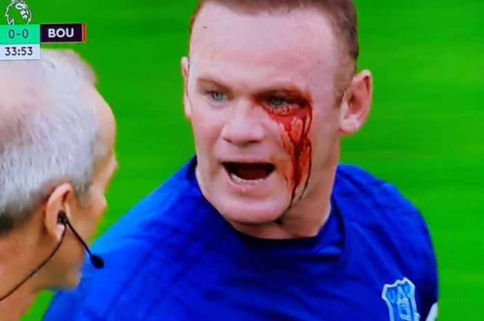 Mata Wayne Rooney yang mengucurkan darah pada laga Everton vs Bournemouth di Liga Inggris, Sabtu (23/9/2017)