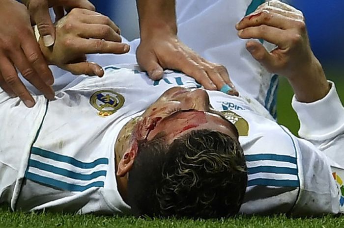 Penyerang Real Madrid Cristiano Ronaldo terbaring di lapangan pertandingan dalam keadaan terluka setelah mencetak gol keduanya ke gawang Deportivo La Coruna dalam pertandingan La Liga Spanyol 2017-2018 di Stadion Santiago Bernabeu, Madrid, Spanyol, pada Minggu (21/1/2018).