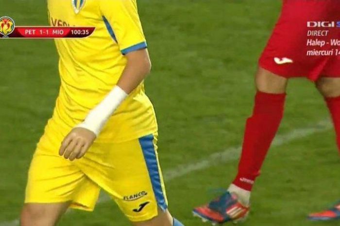 Pemain Rumania, Cosmin Lambru, melakoni debut dengan tangan palsu untuk Petrolul Ploiesti melawan CS Mioveni, Selasa (24/10/2017).