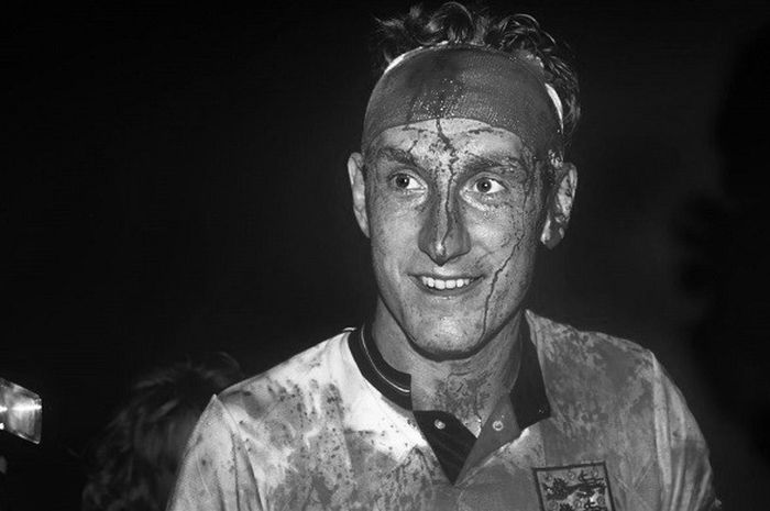 Kapten timnas Inggris tahun 1980-an, Terry Butcher, berlumuran darah usai melawan Swedia di Kualifikasi Piala Dunia 1990.