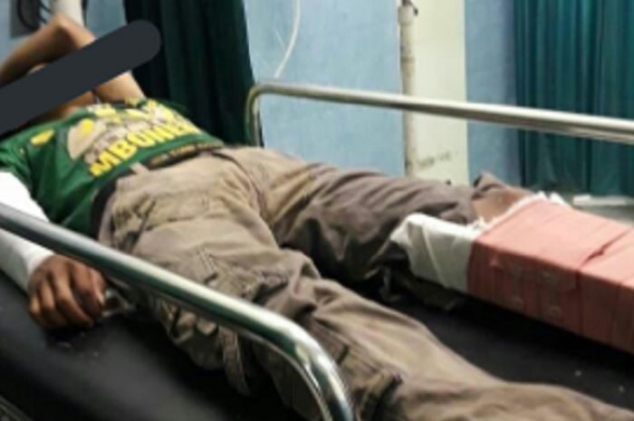 Bonek asal Pasuruan mengalami kecelakaan saat akan menonton pertandingan Persija Vs Persebaya di Stadion Sultan Agung Bantul, Minggu (3/6/2018) 