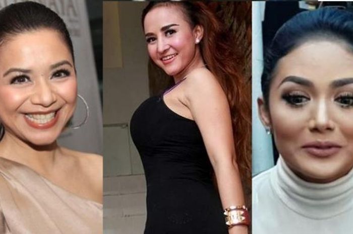 Wow! 9 Artis Indonesia ini Lakukan Operasi Rambut, Payudara Sampai