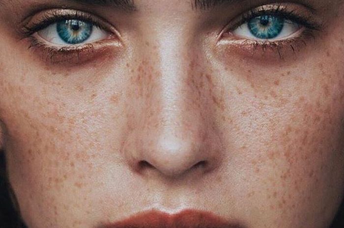 Natural domination sport freckles