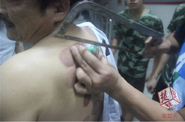 Niatnya Buang Racun Dalam Tubuh Malah Begini Hasilnya