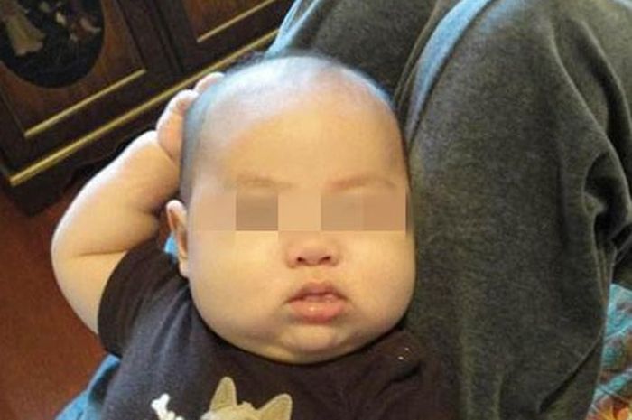 Curiga Anaknya Sering Sentuh Kepala, Ternyata 2 Minggu Kemudian Si Bayi