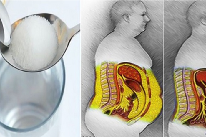 Berikut Adalah Cara Detoks Paling Ampuh Agar Tubuh Bebas Dari Gula Dan Membantu Meningkatkan Kesehatan Hanya Dalam 3 Hari Semua Halaman Intisari
