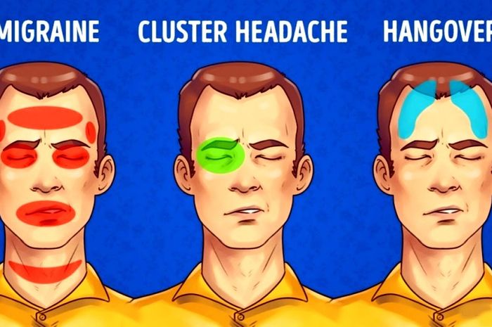 Ini 5 Jenis Sakit Kepala  Beserta Gejala dan Cara Tercepat 