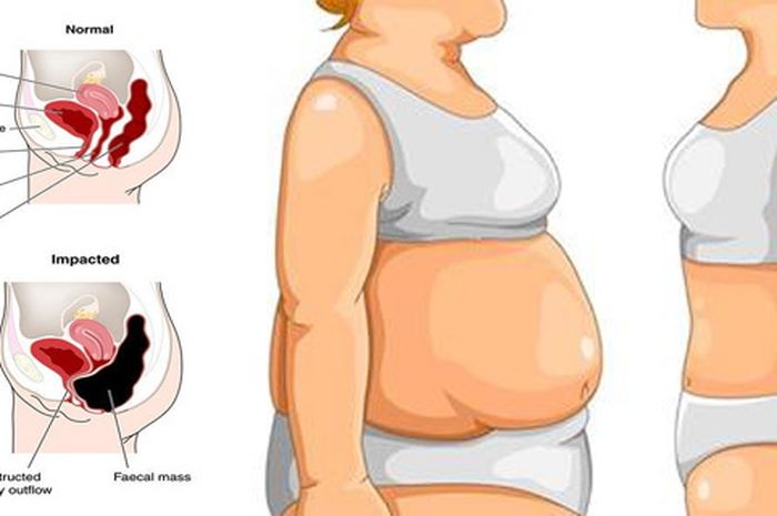 Berat Badan Turun 4 Kilo Dalam 3 Hari Dengan Diet Militer Semua Halaman Nakita