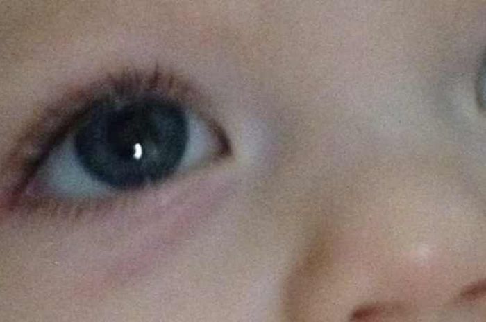 5 Jenis Infeksi Mata Pada Bayi Serta Cara Mengatasinya Semua Halaman Nakita