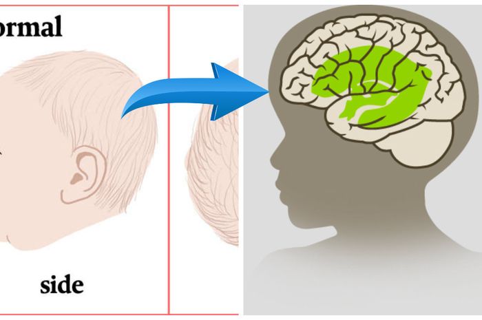 Tren Baru Ortu Di China Pasang Cetakan Kepala Pada Anaknya Demi Kesempurnaan