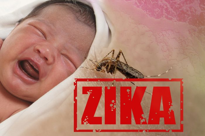 Virus Zika Membuat Risiko Cacat Otak 20 Kali Lebih Besar ...