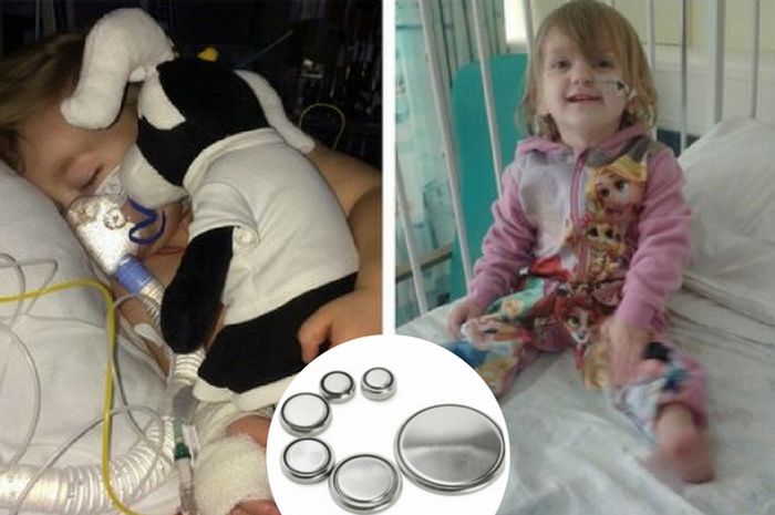 Batita ini Alami Kelumpuhan karena Menelan Baterai Lithium Kecil - Nakita