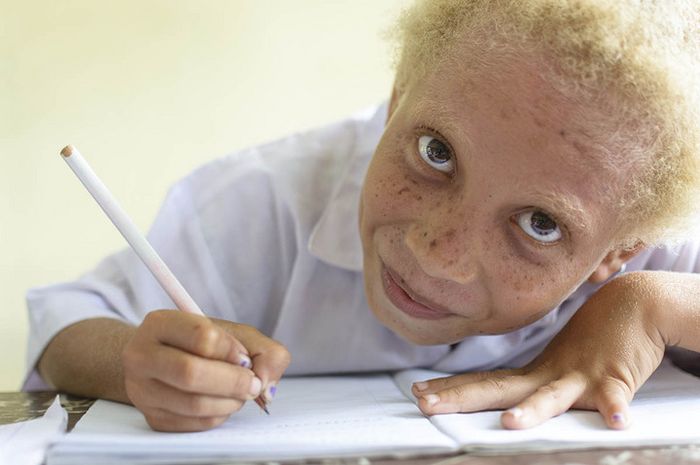 Orang papua albino