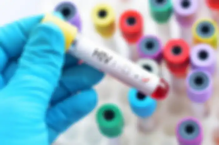 Ketiga anak yatim piatu yang terserang HIV, merupakan penduduk luar yang didatangkan ke RS KHBP Nainggolan untuk dirawat.