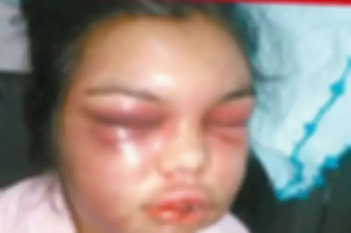 Si suami adalah pria posesif dan pencemburu berat. Dia tega melakukan kekerasan dan menyekap istrinya di rumah.