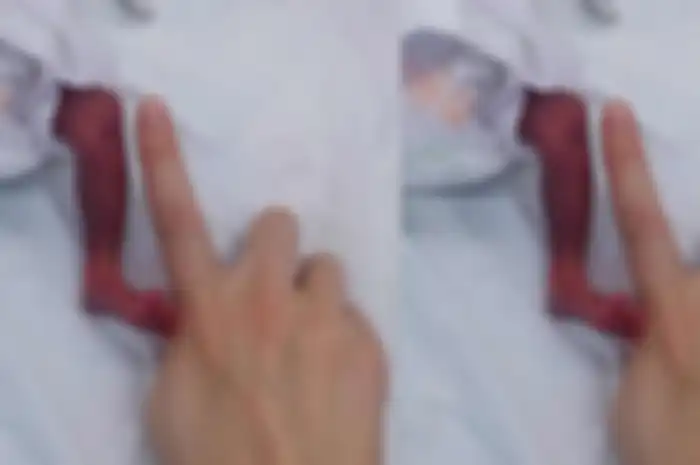Bayi Xiaomi lahir diumur 24 minggu, meski diperkirakan kesempatan hidupnya tipis, namun nyatanya bayi Xiomi hingga kini masih bisa bertahan hidup.
