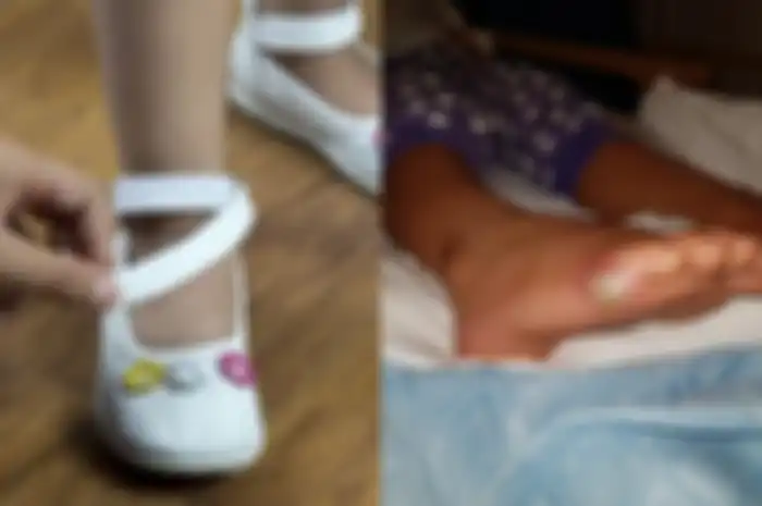 Seorang gadis muda di Inggris dilaporkan terkena infeksi dan mengembangkan sepsis setelah mencoba sepatu baru tanpa mengenakan kaus kaki.