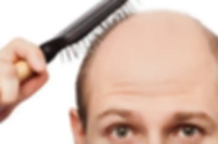 Hati-hati, obat penumbuh rambut bisa bikin pria alami impotensi di usia muda. Ini penyebab lainnya yang perlu diwaspadai.