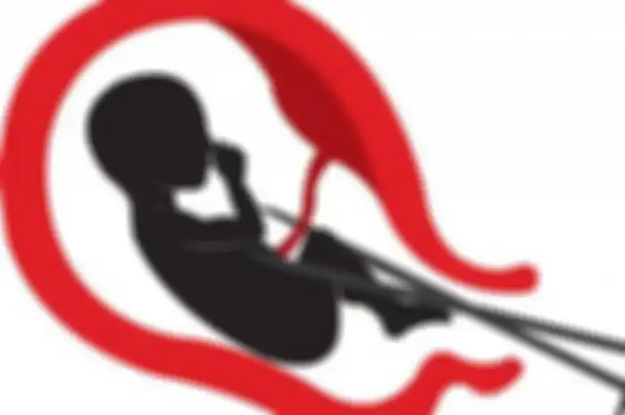 Gea Nila Sari sudah hamil 6 bulan dan M Syaifudin menyuruh kekasihnya tersebut untuk menelan pil aborsi sebanyak 16 butir. 