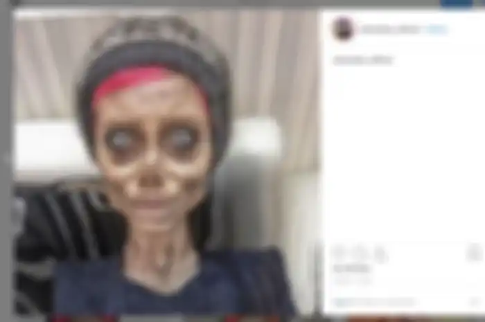 Ketika dirinya sempat viral, Sahar Tahar mengklaim telah menjalani 50 operasi plastik di wajahnya dan kehilangan 40 kg berat badannya.