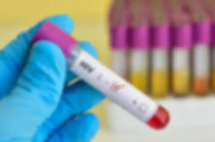 Jika Anda memiliki human immunodeficiency virus, atau HIV, Anda harus sangat waspada tentang menjaga sistem kekebalan Anda kuat.