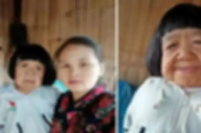 Kulitnya tidak seputih dan lembut seperti anak-anak biasa, tetapi agak kendur dan penuh lipatan, ternyata bocah ini masih berusia 9 tahun.